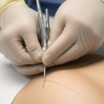 Field Guide to Emergency Wound Closure: Techniques and Best Practices